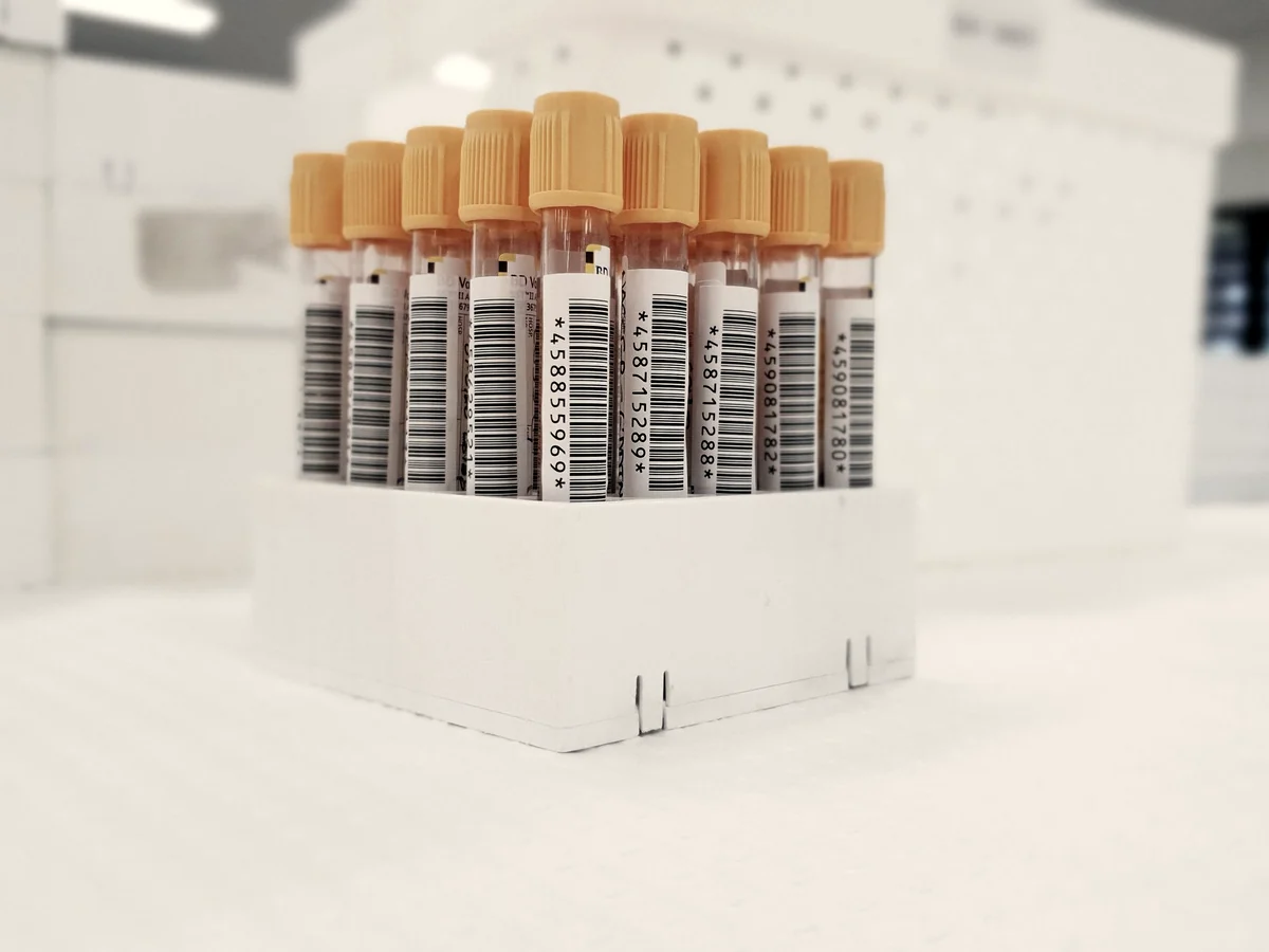 Rack of barcoded laboratory specimen tubes ready for courier collection